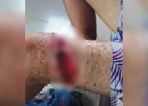 imagem colorida trabalhador acidente motosserra pantanal